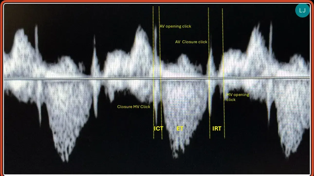 Test Event MOCtesting
